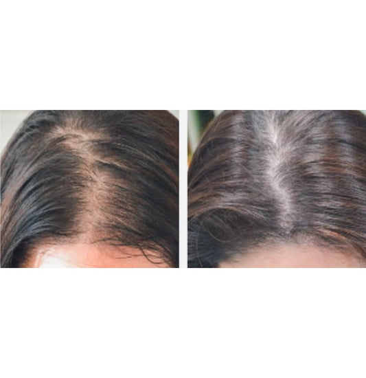 Best Hair Growth Ultra Growth Serum 2.5 oz, Basil & Castor Oil, Extreme Growth Strengthening